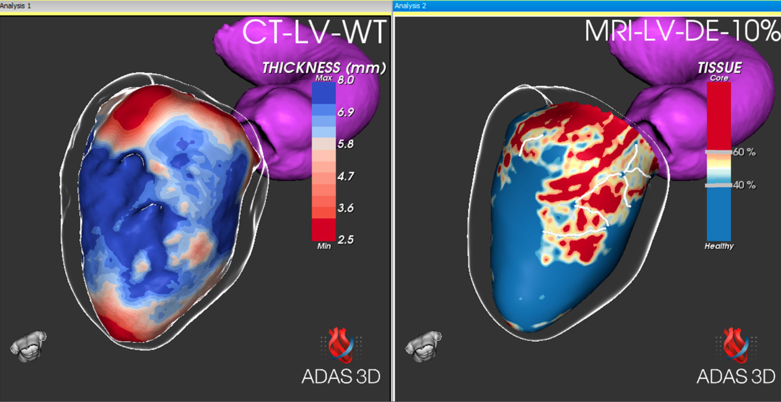 MRI-y-CT---HCB_CT_012_-Izq-es-CT-Derec.-es-MRI