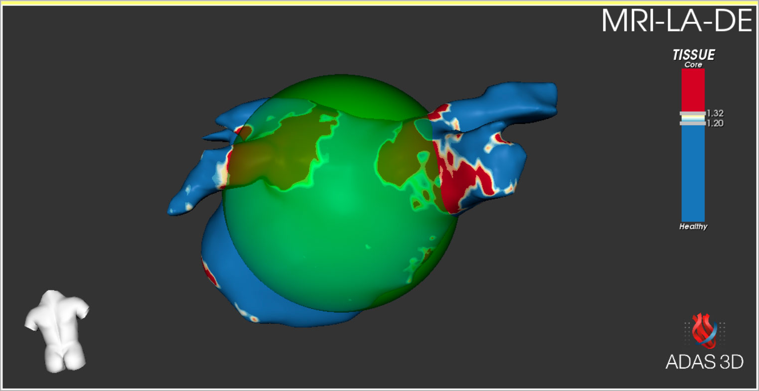 Media---FIBER7_Sphericity