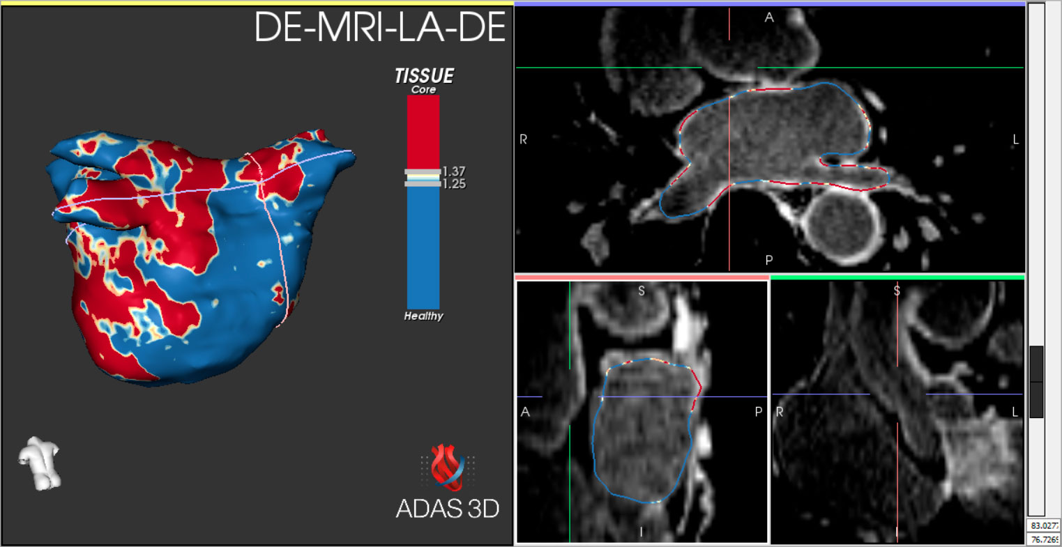 Media---HCB-LA_-DICOM-enhancement-(2)